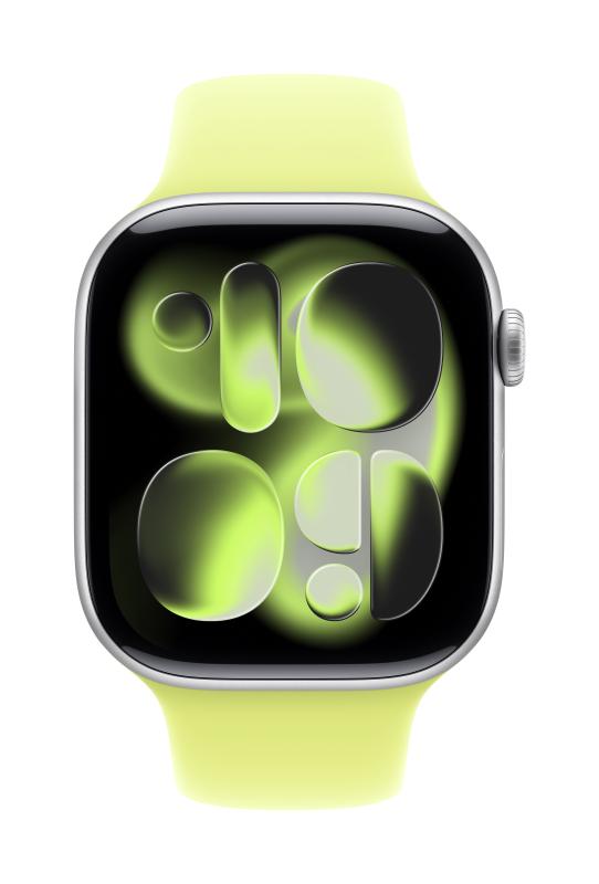817cd3b0c0f5d2a8dc1ff1e0f64cca33.jpg Apple Watch 46mm Neon Yellow Sport Band - M/L - imagine 1